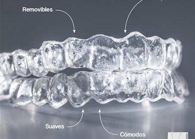 Soul Aligners